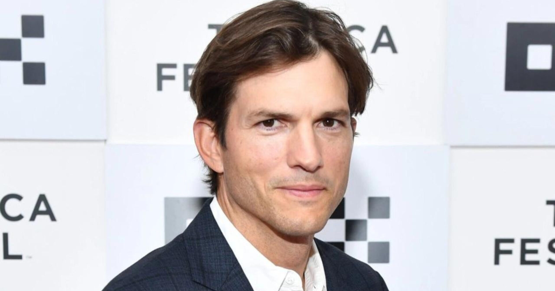 doença autoimune de Ashton Kutcher