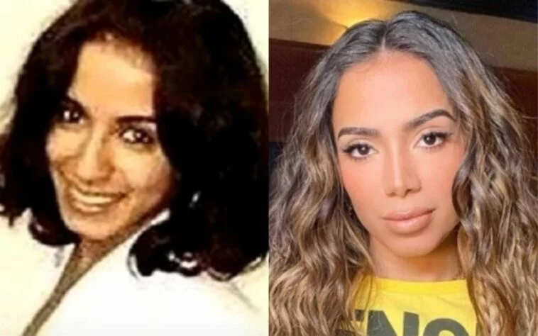 Veja o antes e depois de Anitta e outros artistas