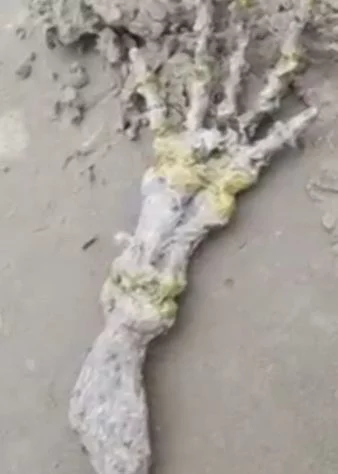 Casal encontra esqueleto de mão na praia
